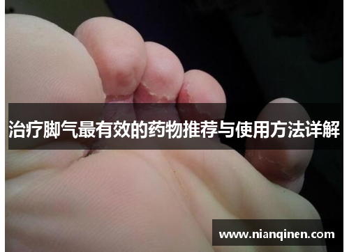 治疗脚气最有效的药物推荐与使用方法详解